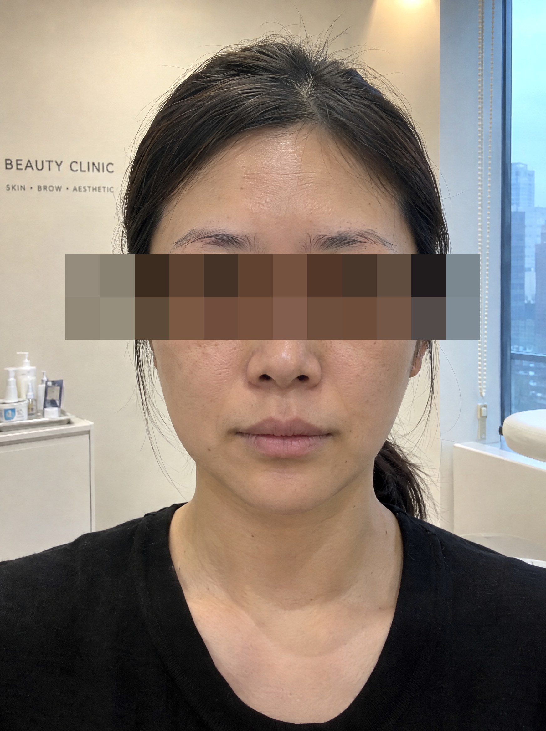 반영구 시술 전 연출 이미지