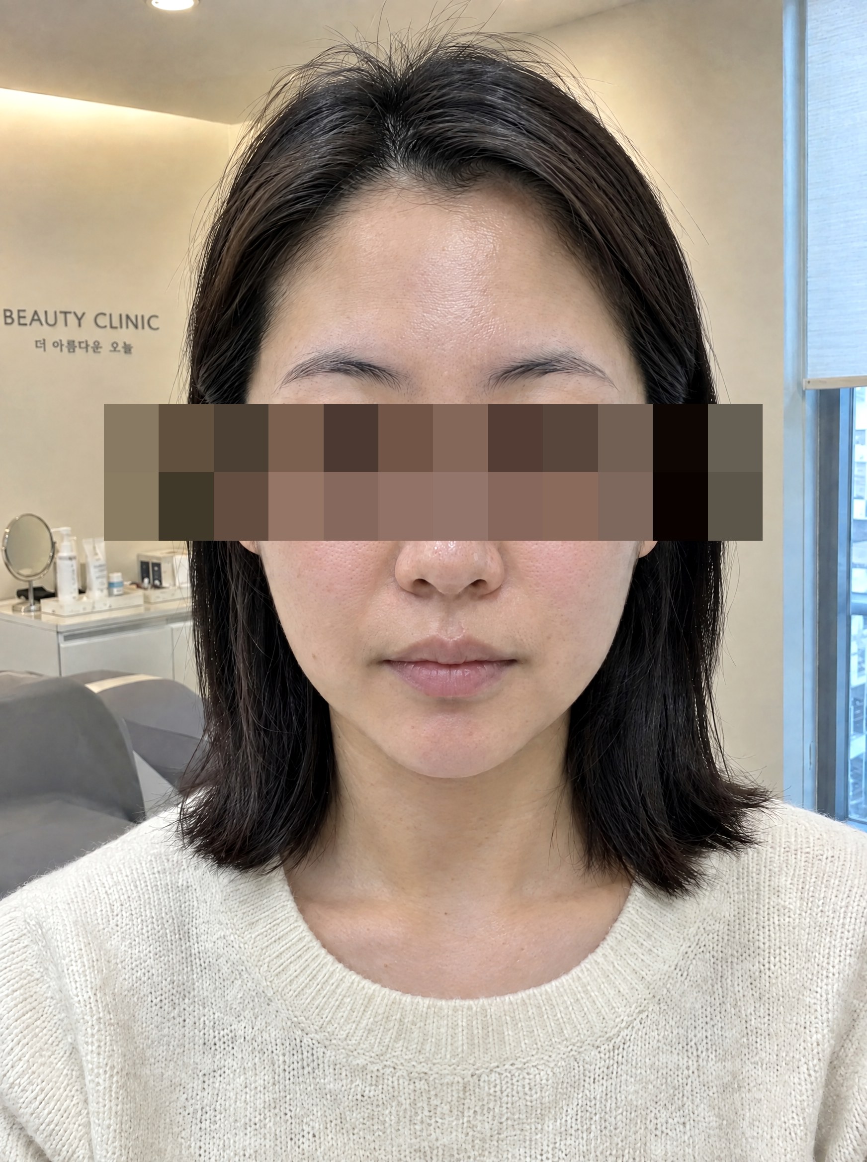 스킨케어 시술 후 연출 이미지