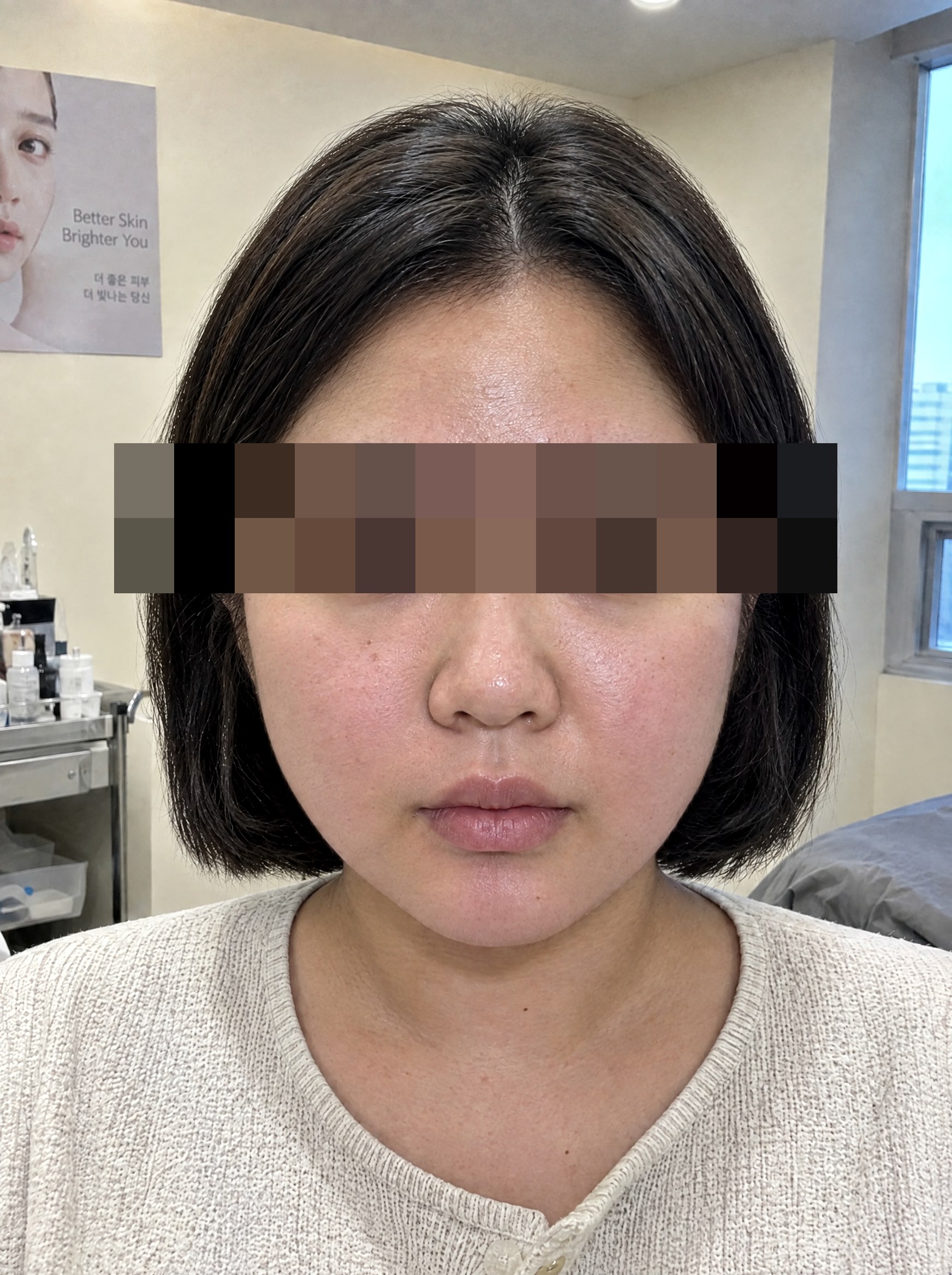 왁싱 시술 후 연출 이미지
