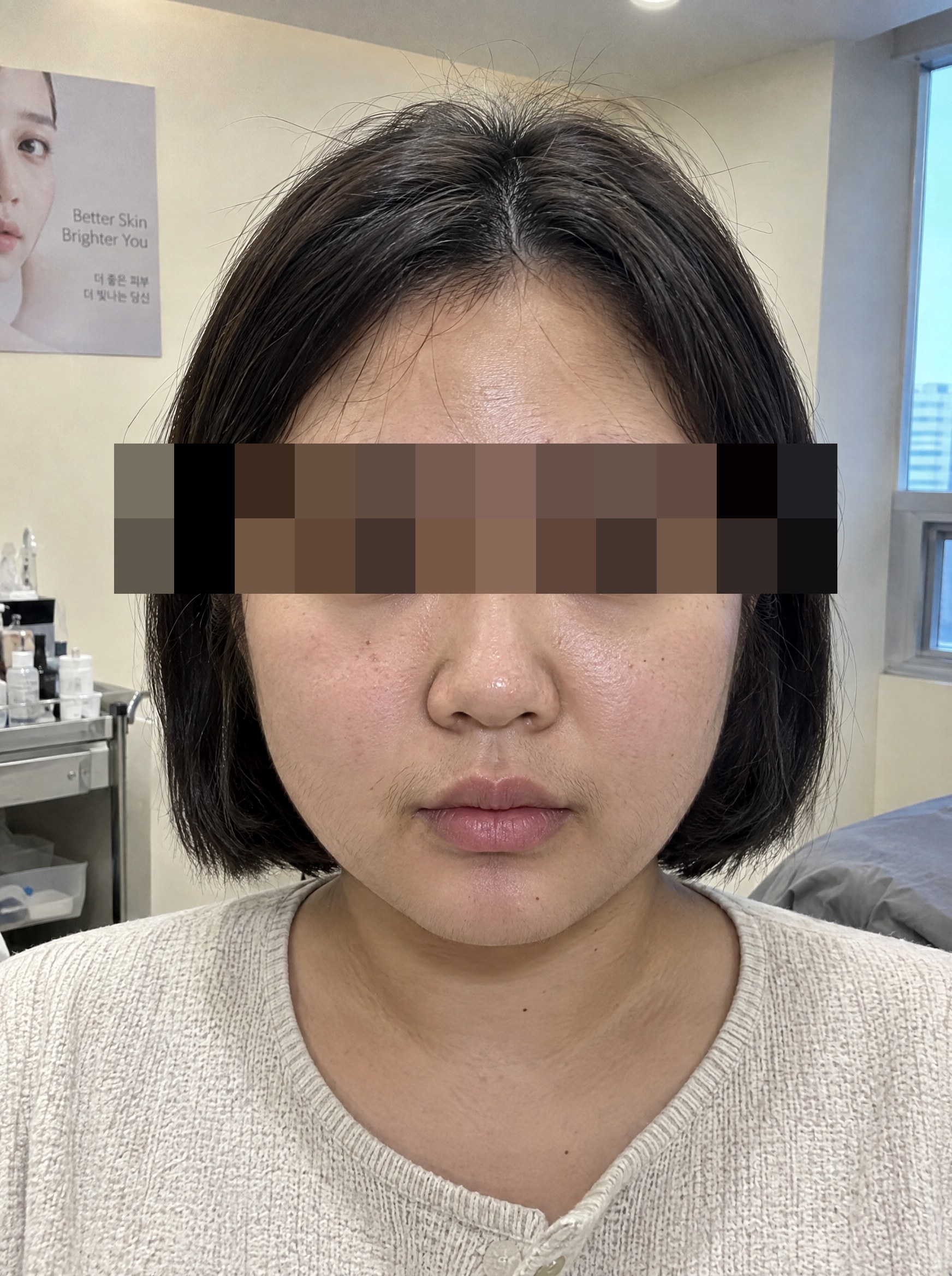 왁싱 시술 전 연출 이미지